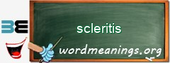 WordMeaning blackboard for scleritis